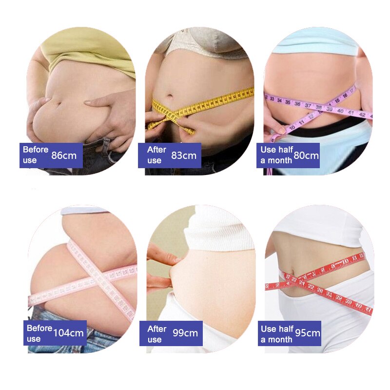 Sheath Modeling Weight Loss Waist Trainer Tummy Control Slimming Shapewear - Tummy Control - DYAVOR®