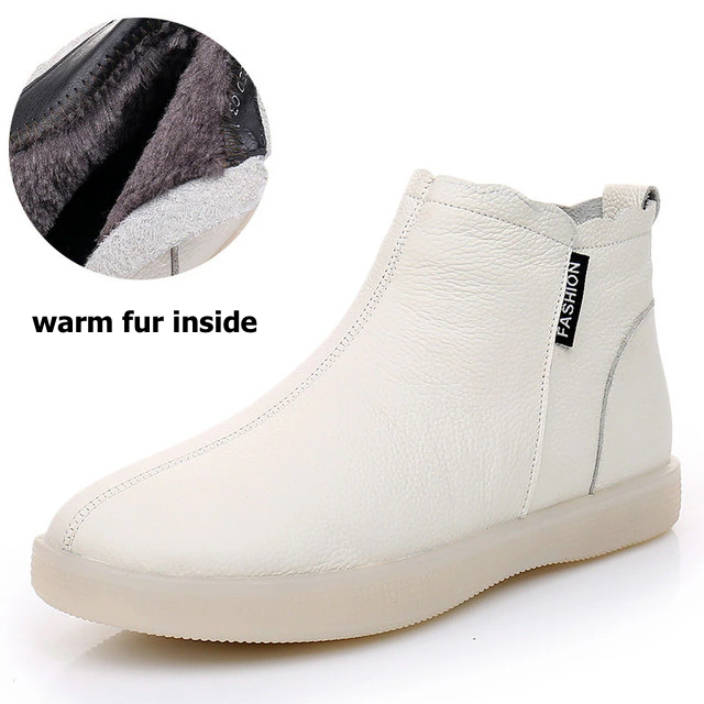 GRW Orthopedic Boots For Women Leather Comfortable Ankle Fur Lined Warm Winter Shoes - Orthopedic Shoes - DYAVOR®