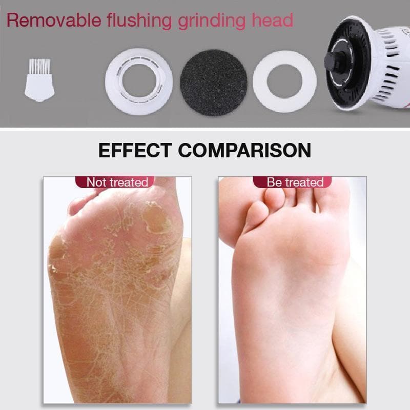 Electric Vacuum Adsorption Foot Grinder - Beauty And Personal Care - DYAVOR®