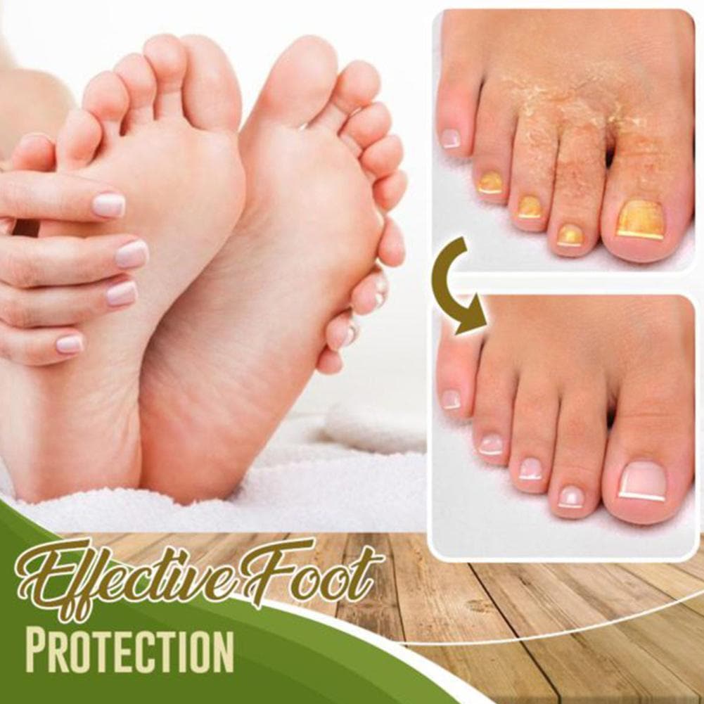Fungal Treatment Foot Spray - Beauty And Personal Care - DYAVOR®