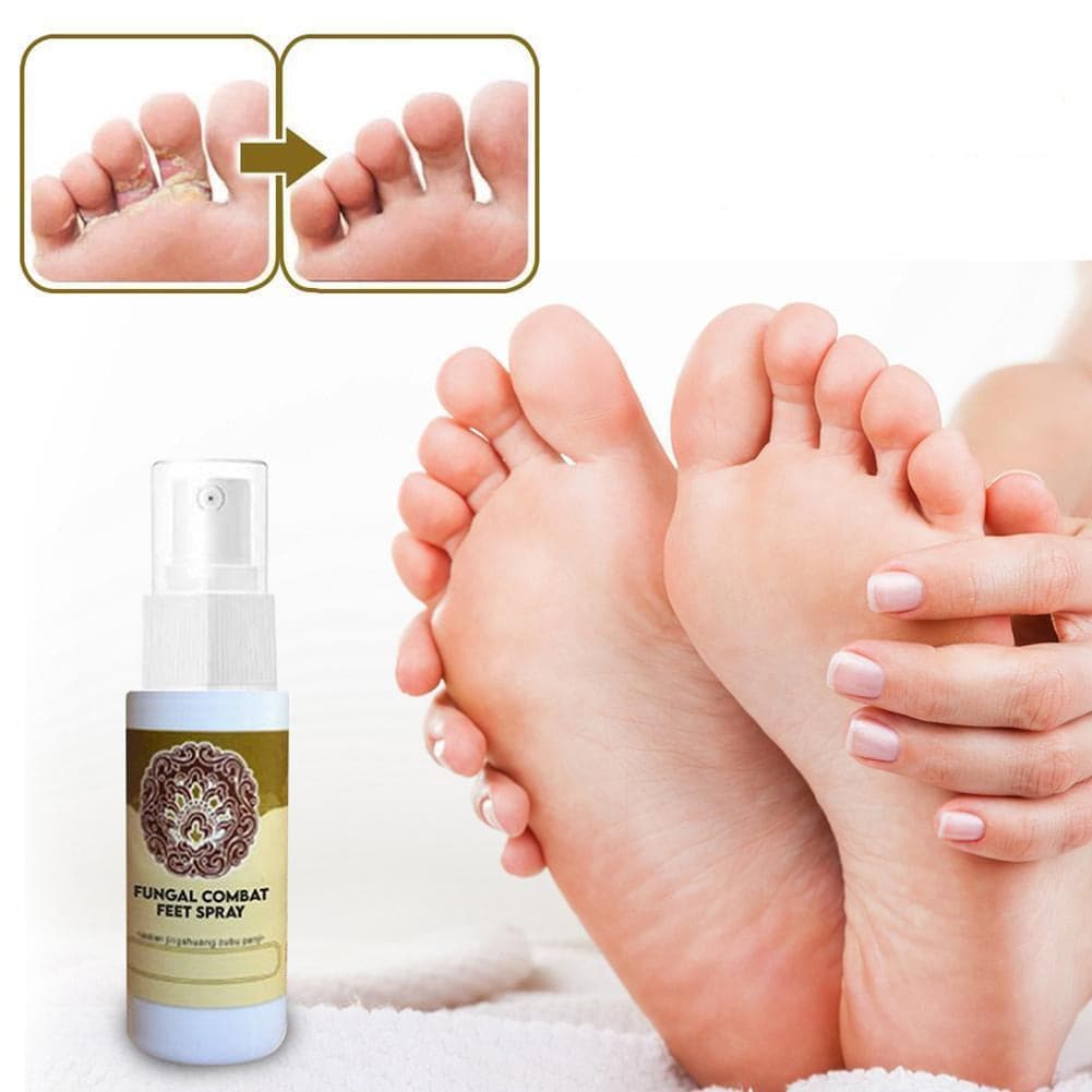 Fungal Treatment Foot Spray - Beauty And Personal Care - DYAVOR®