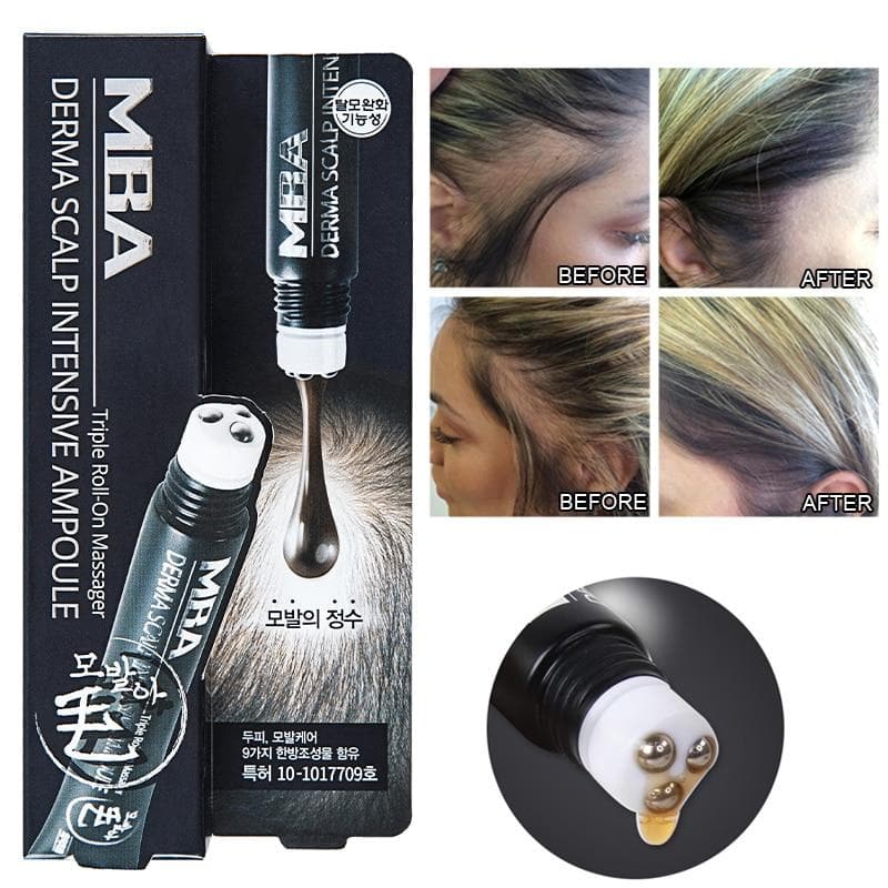 Scalp Intense™ - Hair Growth Serum - Personal Care - DYAVOR®