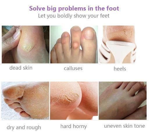 Silky Feet™ - Exfoliating Foot Masks (Buy 1, Get 2 FREE) - Beauty And Personal Care - DYAVOR®