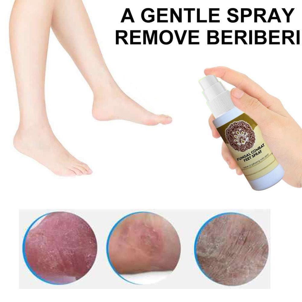  Fungal Treatment Foot Spray - Beauty And Personal Care - DYAVOR® 